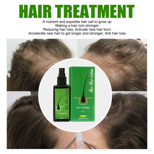 Hair Care Growth Lotion Spray – Boost & Nourish - Image 5